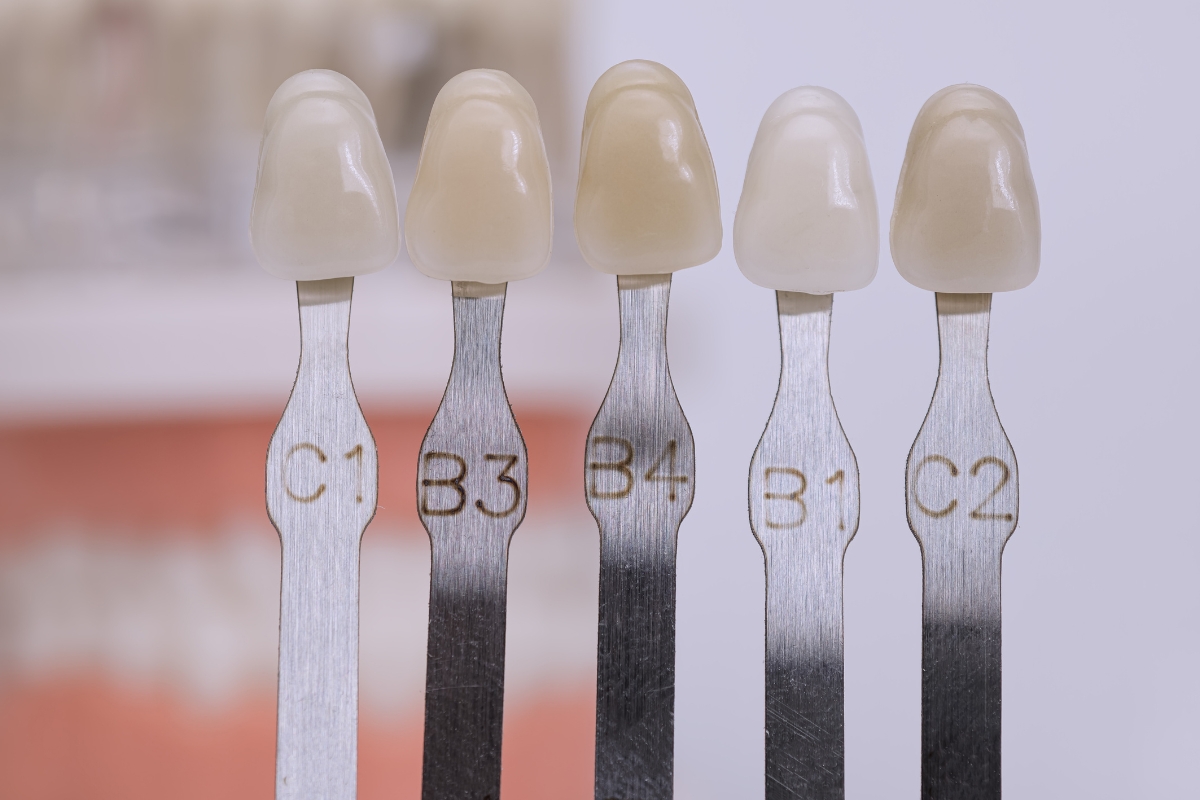 porcelain-veneers-in-Mogadore