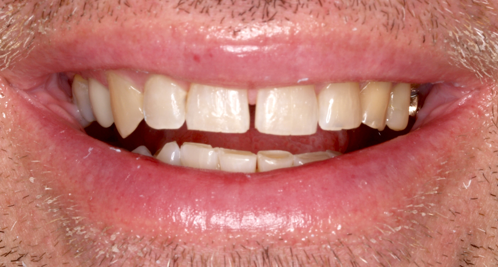 Periodontal Care in Mogadore