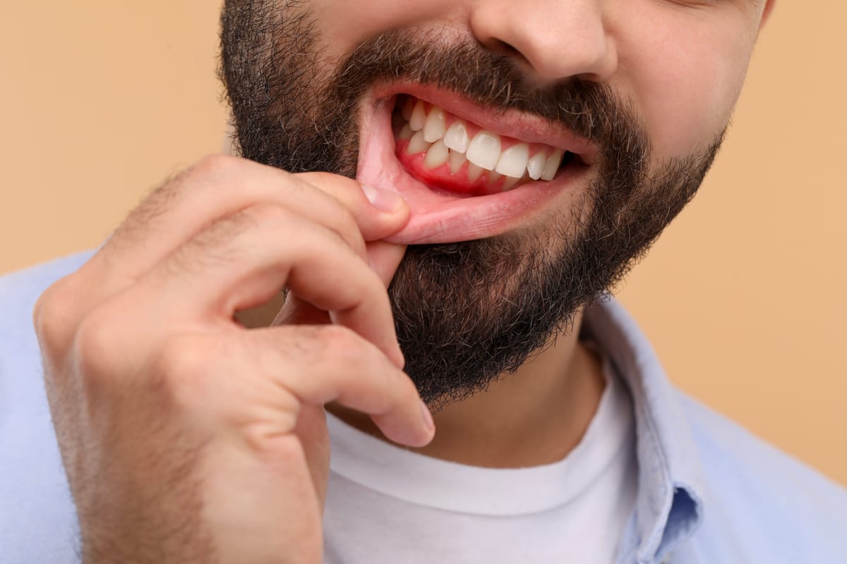 Periodontal Care in Mogadore