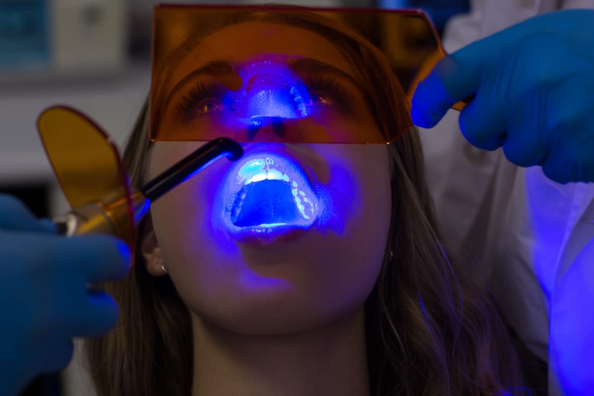 Teeth Whitening in Mogadore